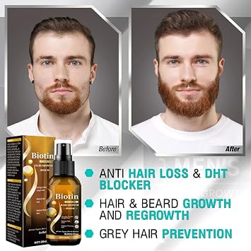 Biotin Hair Growth Serum,Hair Growth Spray Containing Ginseng Root Extract and Ginger Root Extract,Moisturizes the scalp, strengthens hair follicles, prevents hair loss, and promotes hair growth.