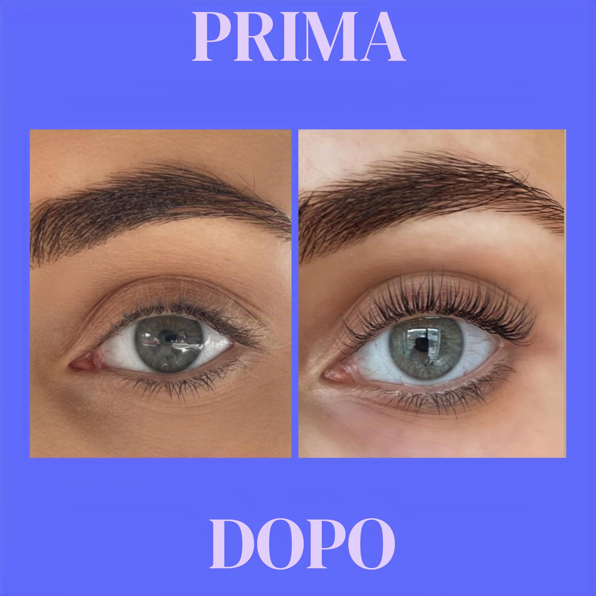 Xlash Eyelash Siero 3Ml per la beauty routine quotidiana, per trattamento mirato e luminosità, 3ml