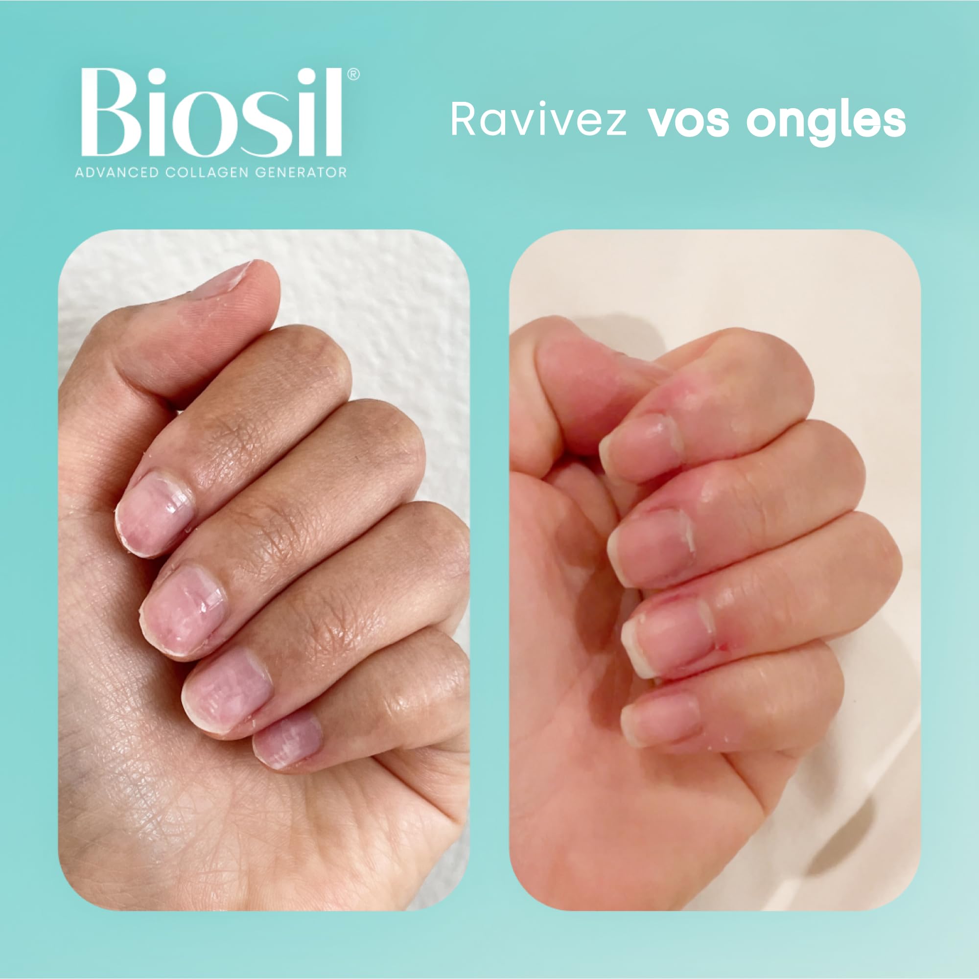 Biosil Collagen Generator - 60 Capsules | Avec le complexe breveté ch-OSA - génère et protège votre propre collagène - Sans OGM - Approvisionnement pour 30 jours