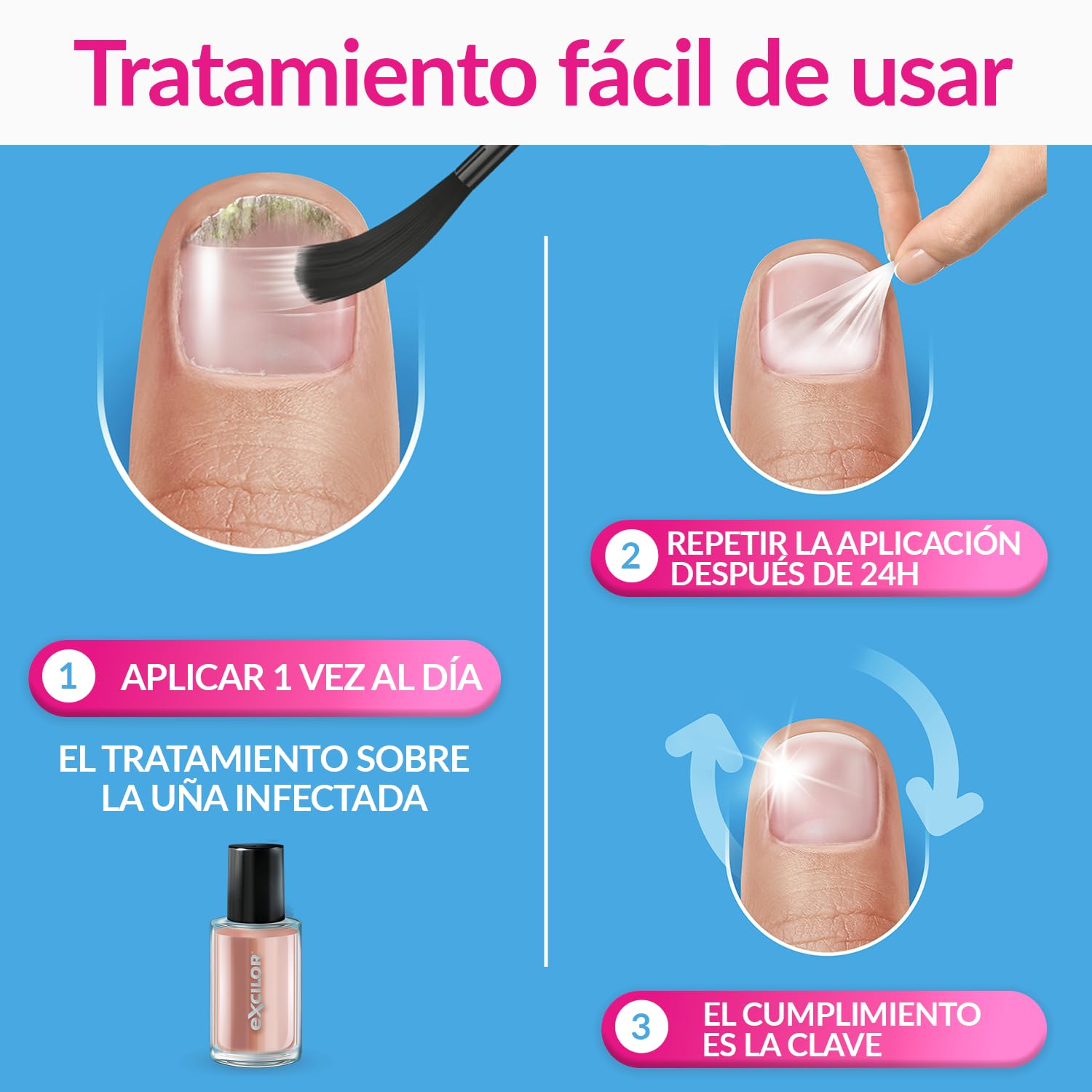 EXCILOR - Tratamiento De La Micosis De Las Uñas - Forte Color Nude - Fórmula Extra Fuerte - Tratamiento y Cobertura - Tratamiento para uñas 30 ml + Esmalte 8 ml - Clínicamente probado