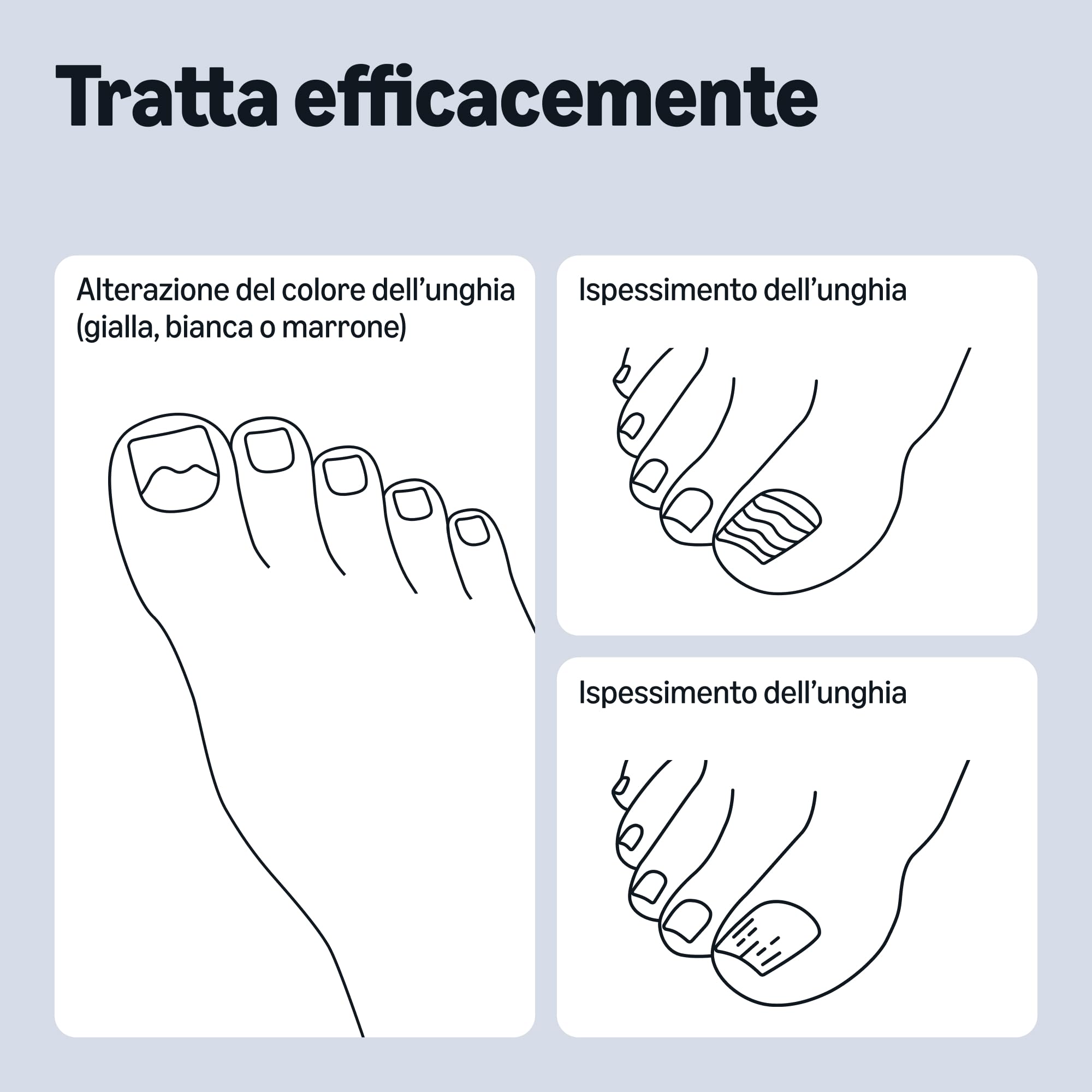 Healthcare by Amazon Liquido per il Trattamento delle Unghie Fungine, 10ml (in Precedenza Amazon Basic Care) - L'Imballaggio Può Variare