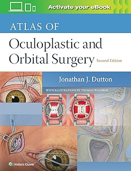 ATLAS OF OCULOPLASTIC AND ORBITAL SURGERY 2ED (HB 2019) 
