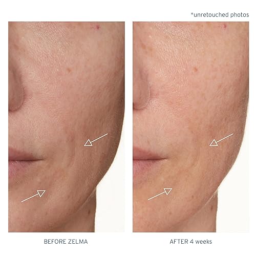 Miniatura 7 de Santo Remedio Piel Eterna ZELMA - Suero iluminador de 1 onza líquida suero de vitamina C con complejo mineral péptidos Sacha Inchi ácido hialurónico
