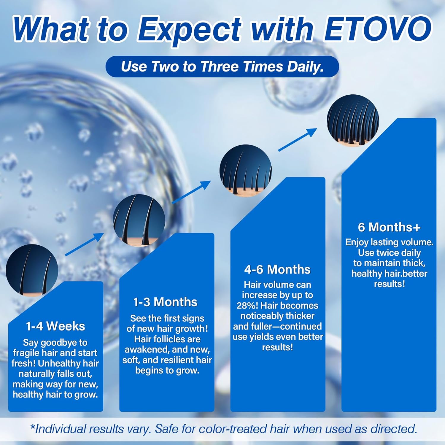 5% Minoxidil for Women Hair Growth Spray Serum Topical Minoxidil Hair Regrowth Thicker Prevent Hair Loss for Thickening Longer Fuller Healthier Hair 3 Bottles of 2oz - Image 3