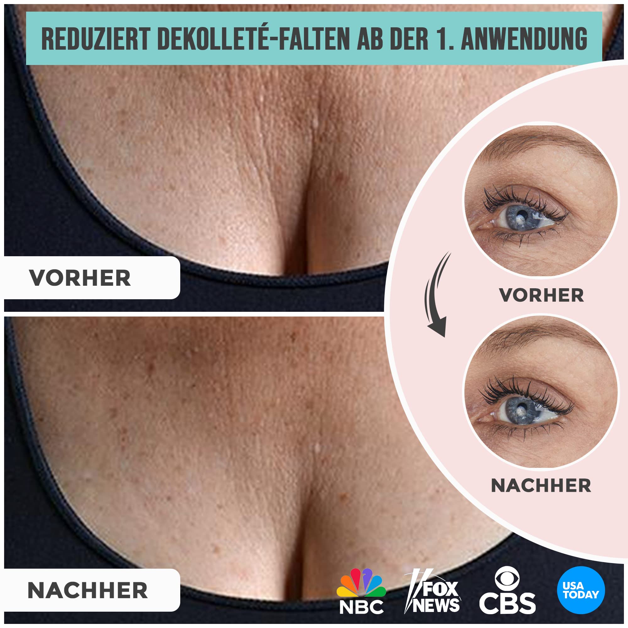 Antifalten Dekolleté Pads + GRATIS Augenpads | Dekoltee Pad, Stirn Pad & Augenpads zur Faltenreduktion | bis zu 30x Wiederverwendbar | 3in1 Set | I Anti Falten Pads & Anti Aging I 3 St.