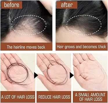 Batana Oil Hair Treatment, Batana Oil For Hair Growth, Batana Oil Organic, Conditioner Leave in Botanical Extracts & Vitamins, Batana Oil Conditioner Leave In Botanical Extracts & Vitamins 120 ml (1