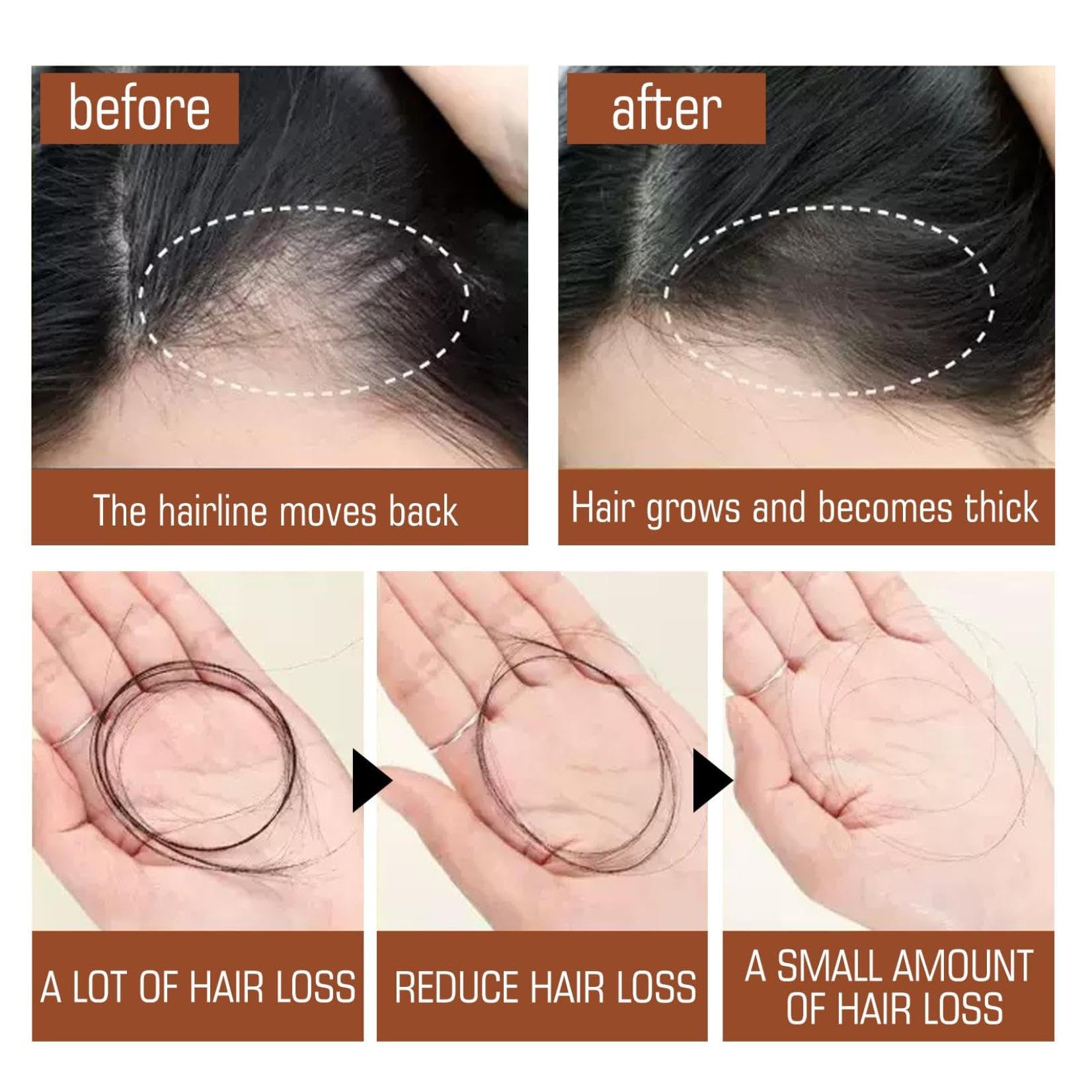 Batana Oil Hair Treatment, Batana Oil For Hair Growth, Batana Oil Organic, Conditioner Leave in Botanical Extracts & Vitamins, Batana Oil Conditioner Leave In Botanical Extracts & Vitamins 120ml (5PC)
