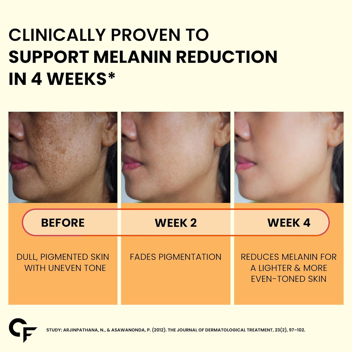 Carbamide Fort Japanese reduced the tablets of L Glutathion, which is with vitamin C from Amla extracts, collagen, lycopene combo pack for skin health (1000mg) - 30 wedge tablets each Carbamide Fort Japanese reduced the tablets of L Glutathion, which is with vitamin C from Amla extracts, collagen, lycopene combo pack for skin health (1000mg) - 30 wedge tablets each