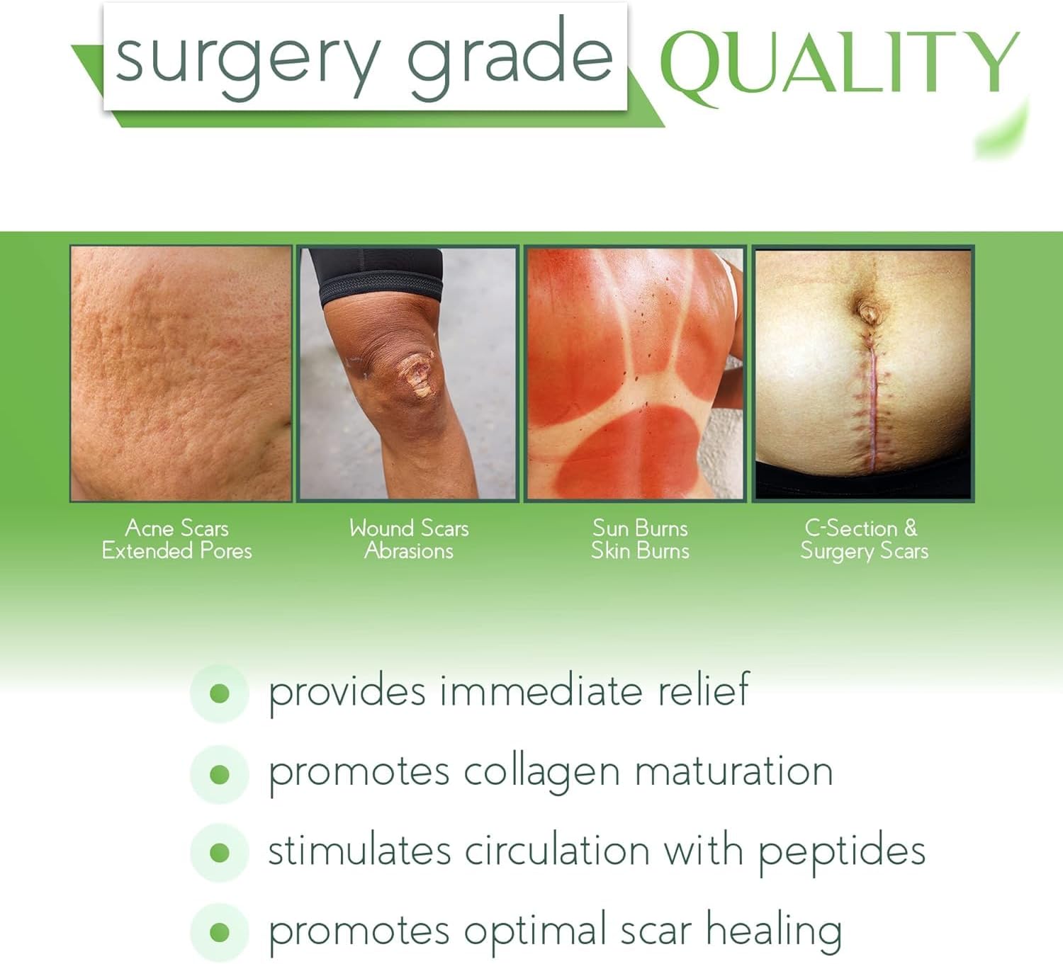 Dr. Speron's - 4th Gen - Natural Silicone Scar Gel – Promotes Natural Regenerative Activity, Clinically Shown to Make Scars Less Visible – 1.41 oz