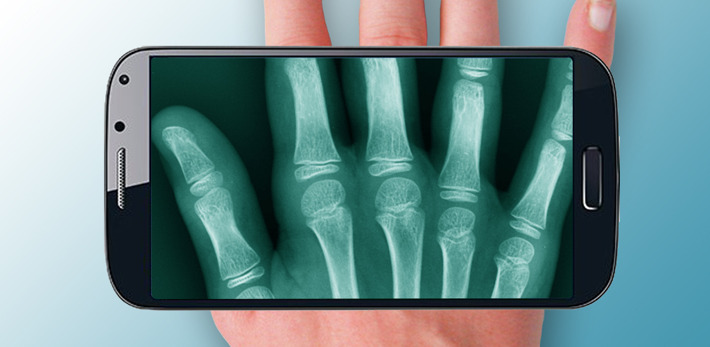 Aplicación Amazing XRay en Amazon Appstore