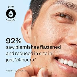 Peach Slices - Acne Spot Dots (30 ct) - Hydrocolloid Pimple Patches for Face - Absorb Gunk, Protect Picking & Support Healing - 3 Sizes (7, 10, & 12mm) - Vegan, Cruelty Free, Korean Skin Care & Beauty