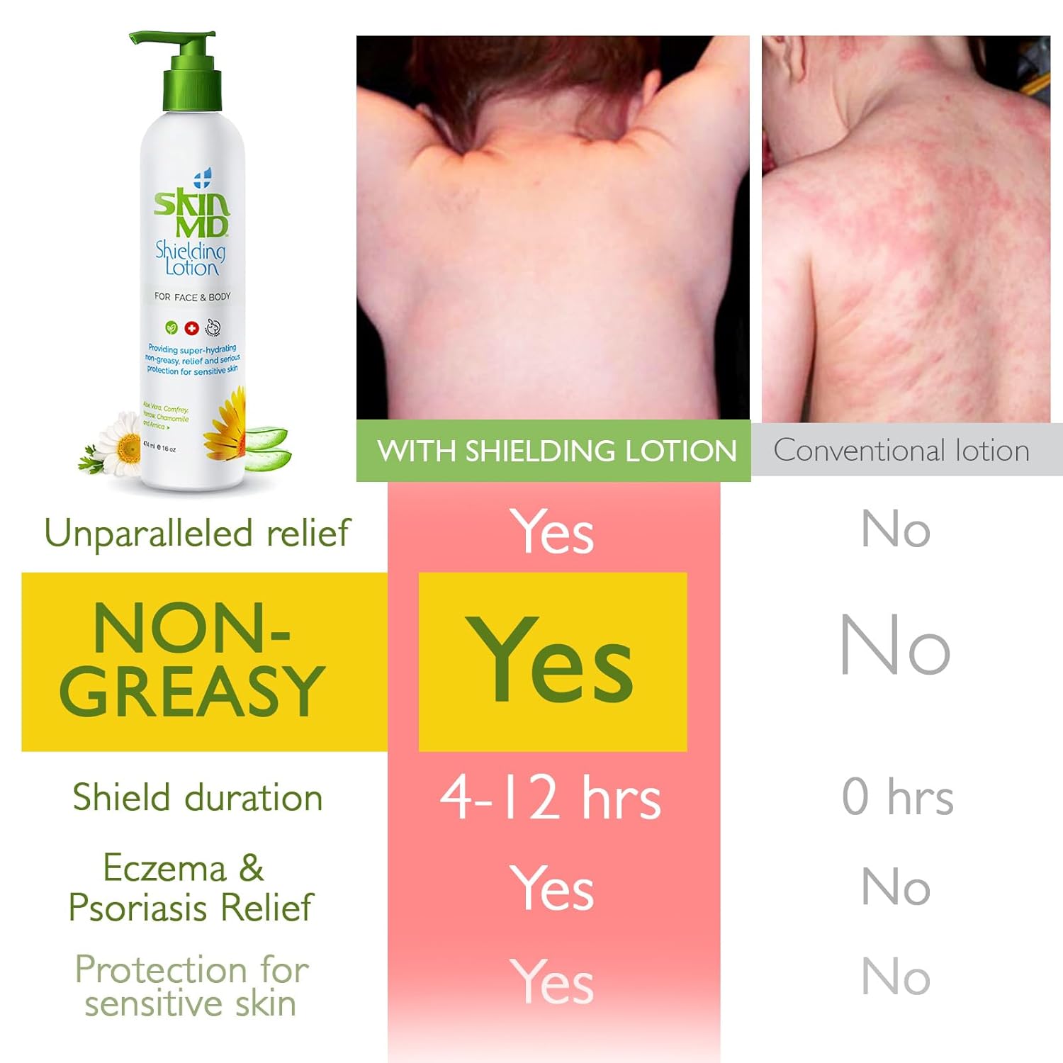 Skin MD Shielding Lotion Hydrating Body Lotion for Sensitive Skin with Dispenser | Non-Greasy, Fast-Absorbing Moisturizer with Plant-Based Ingredients, Eczema & Psoriasis Relief - 16oz Pump