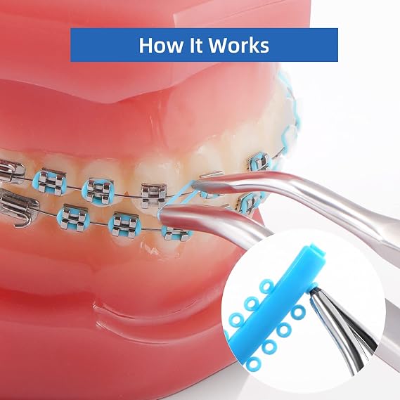 العلاقات مع تقويم الأسنان أقواس 1040 قطعة ، أقواس ألوان أقواس روابط الرباط حلقات O المرنة للأقواس ( لون متعدد )