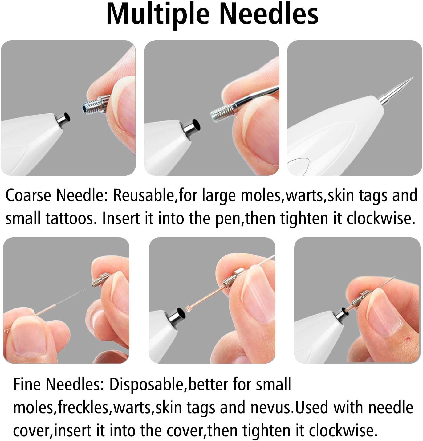 Skin Tags Remover Pen, VOONEEN Mole Remover with 9 Strength Levels &LED Spotlight - Image 5