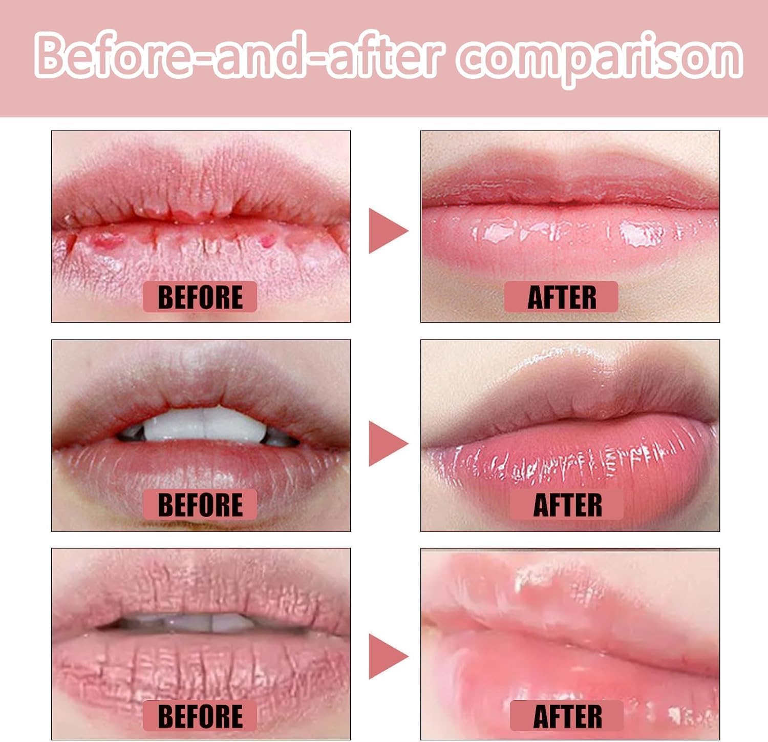 Lip Mask 15PCS Collagen Crystal Lip Mask Set, Deeply Hydrating, Nourishing & Anti-Wrinkle Treatment - Image 3