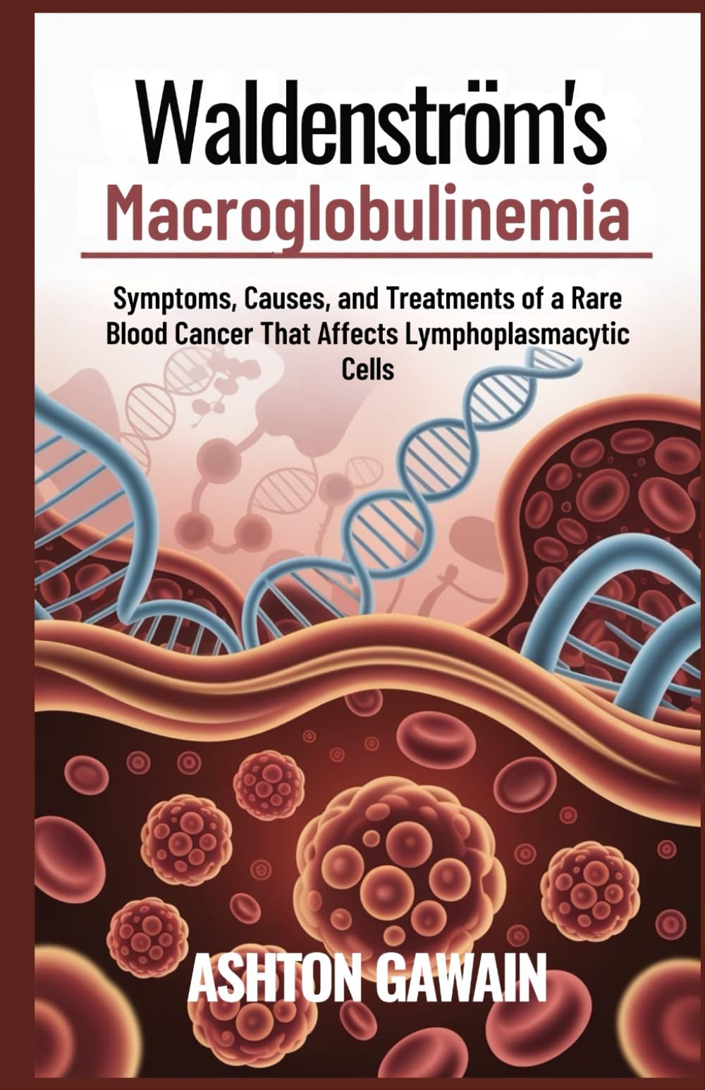 Waldenström’s Macroglobulinemia: Symptoms, Causes, and Treatments of a Rare Blood Cancer That Affects Lymphoplasmacytic Cells