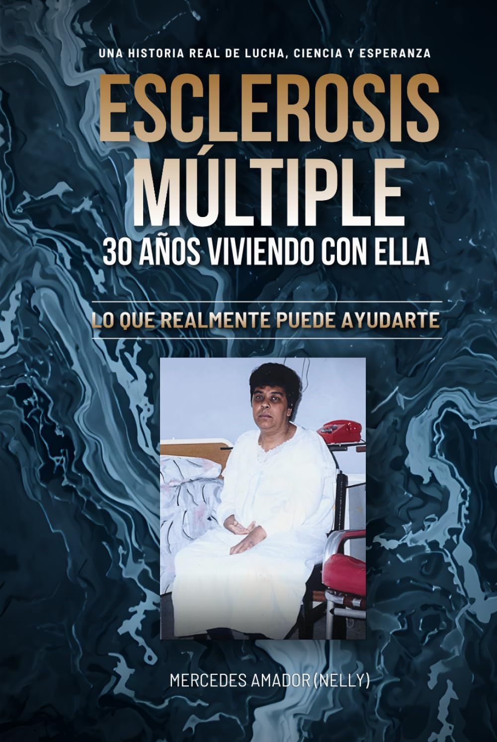 ESCLEROSIS MÚLTIPLE 30 AÑOS VIVIENDO CON ELLA: LO QUE REALMENTE PUEDE AYUDARTE