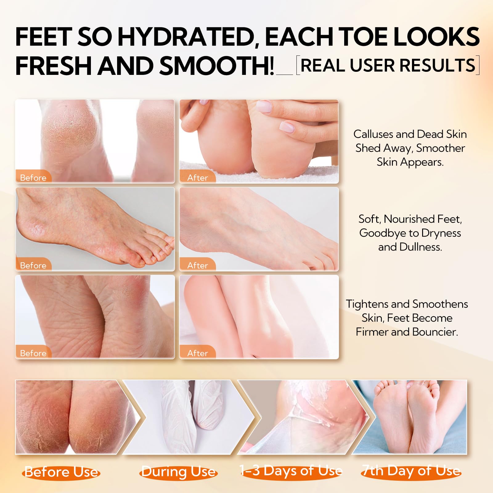 LANBENA Vitamin C Foot Peeling Mask, Foot Mask for Dry Cracked Feet Exfoliator Peel Off Calluses Dead Skin Callus Remover - Image 4