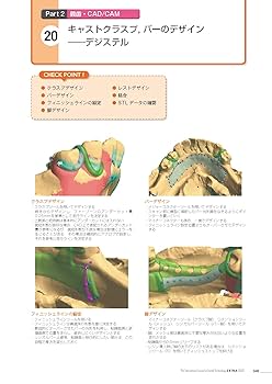 Amazon.co.jp: 歯科技工別冊 アナログもデジタルも! 保険も自費