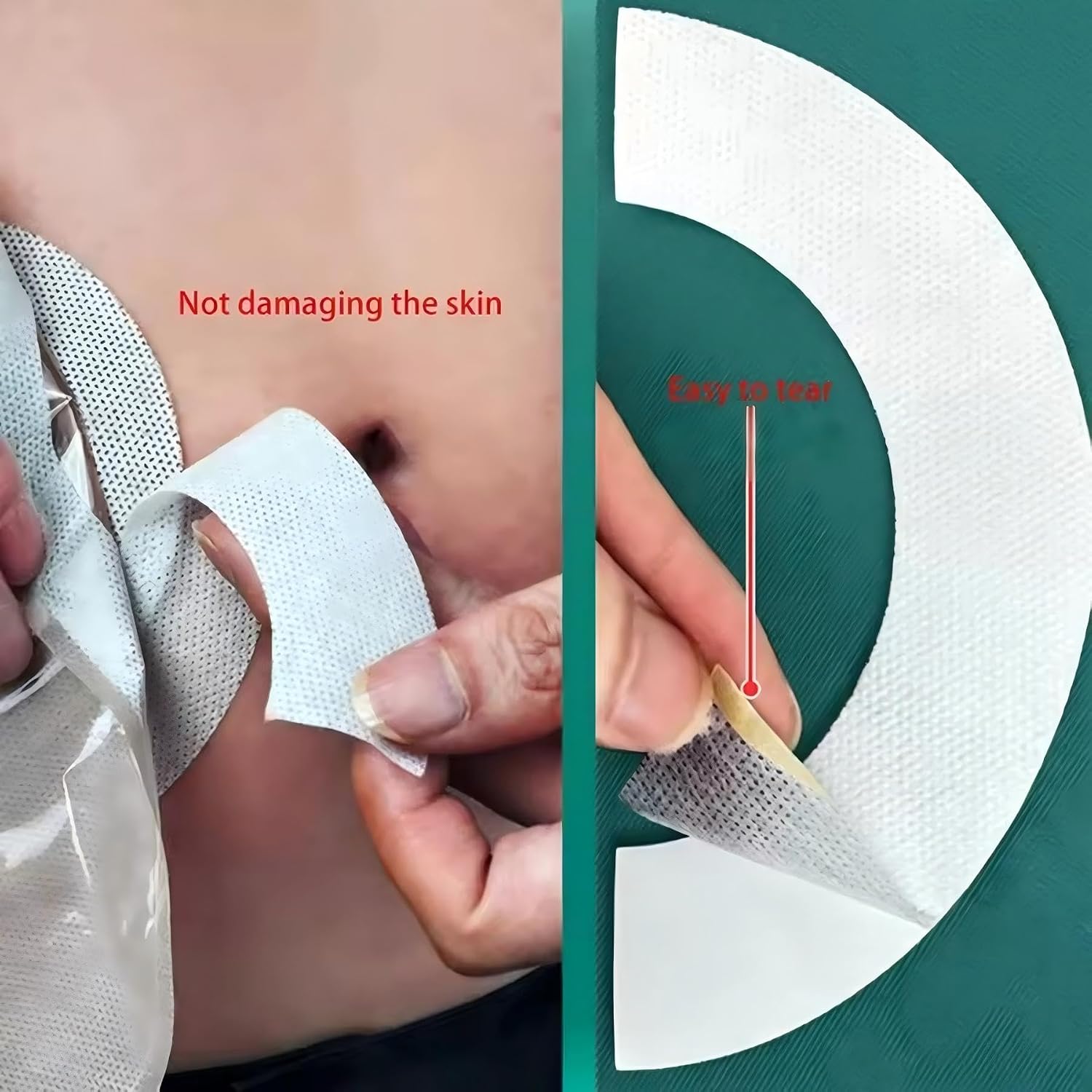 Elastic Barrier Strips for Colostomy Bags Fixation,20Pcs Hydroentangled Ostomy Barrier Strips,Stoma Pouch Pressure-Sensitive Tape for Reinforcing Stoma Baseplate Accessories(Curved Pre-Cut)