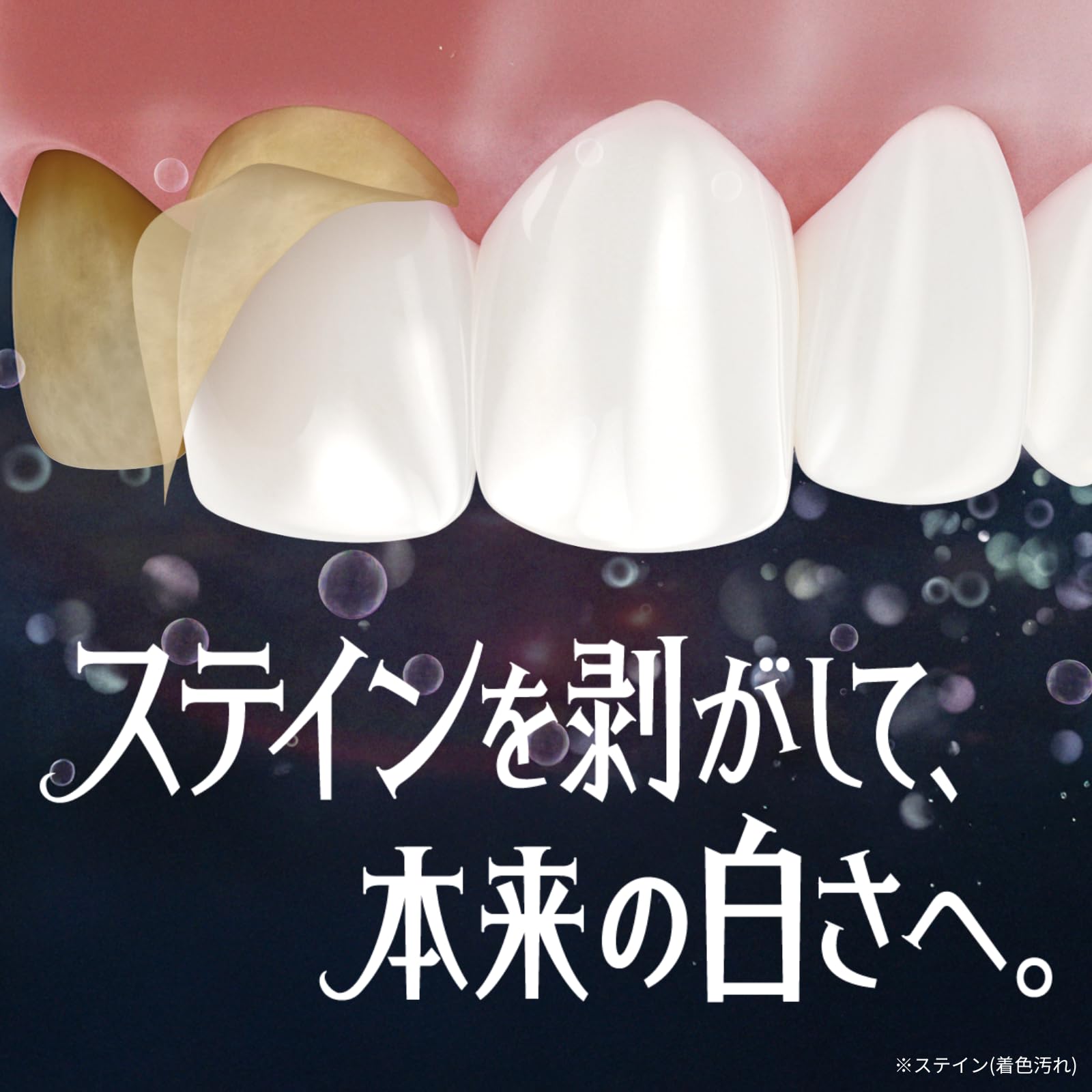 Ora2(オーラツー) プレミアム 【医薬部外品】 ステインクリア ハミガキ [プレミアムミント] (ホワイトニング 美白 歯磨き粉 歯の黄ばみ 着色汚れ 口臭ケア) 100g×2個+歯ブラシ付き - 2