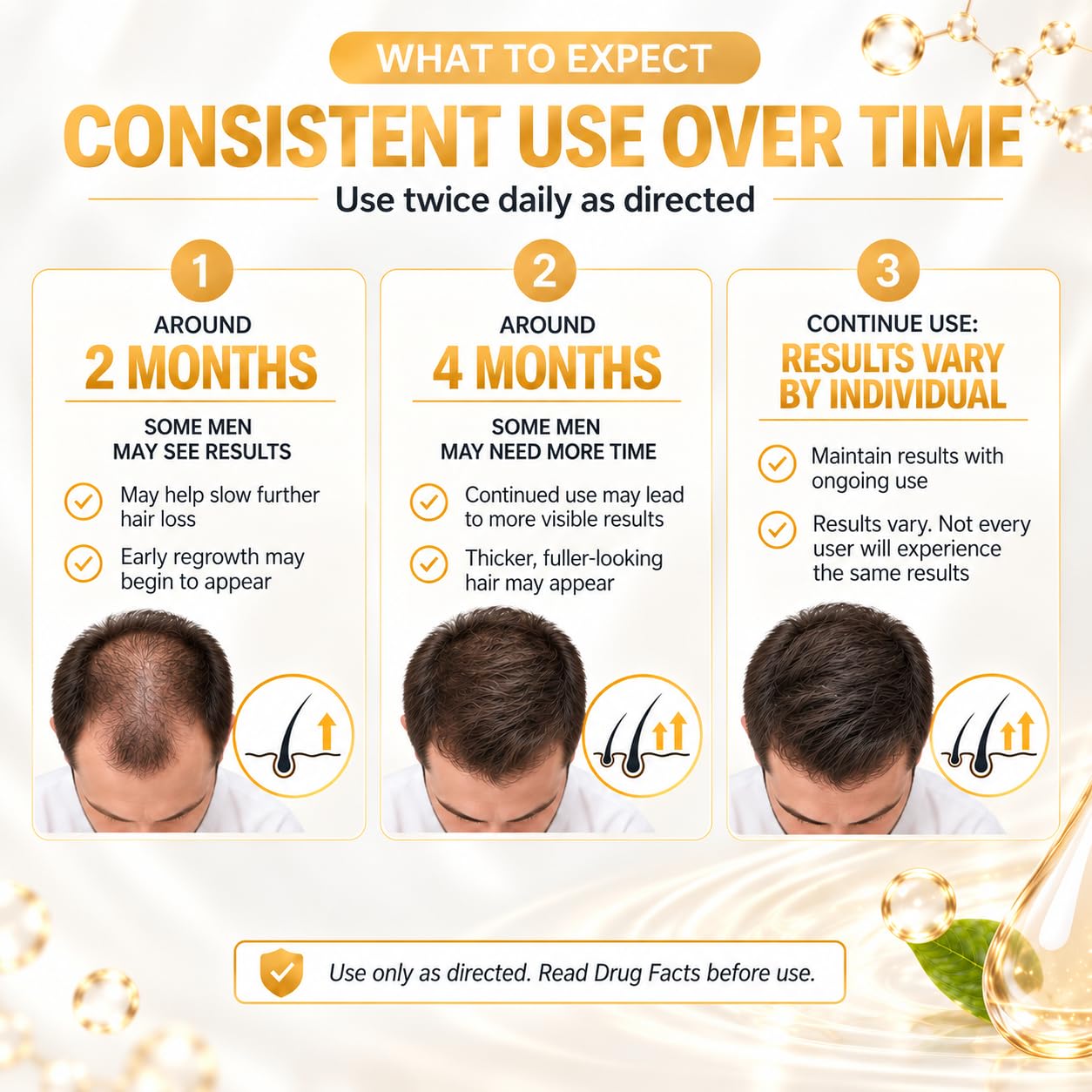 Minoxidil for Men Hair Growth, Extra Strength Hair Growth Serum Topical Solution Hair Regrowth Treatment for Men Clinically Proven to Reactivate Hair Follicles, 60 mL (2.02 Fl Oz) – 1 Month Supply