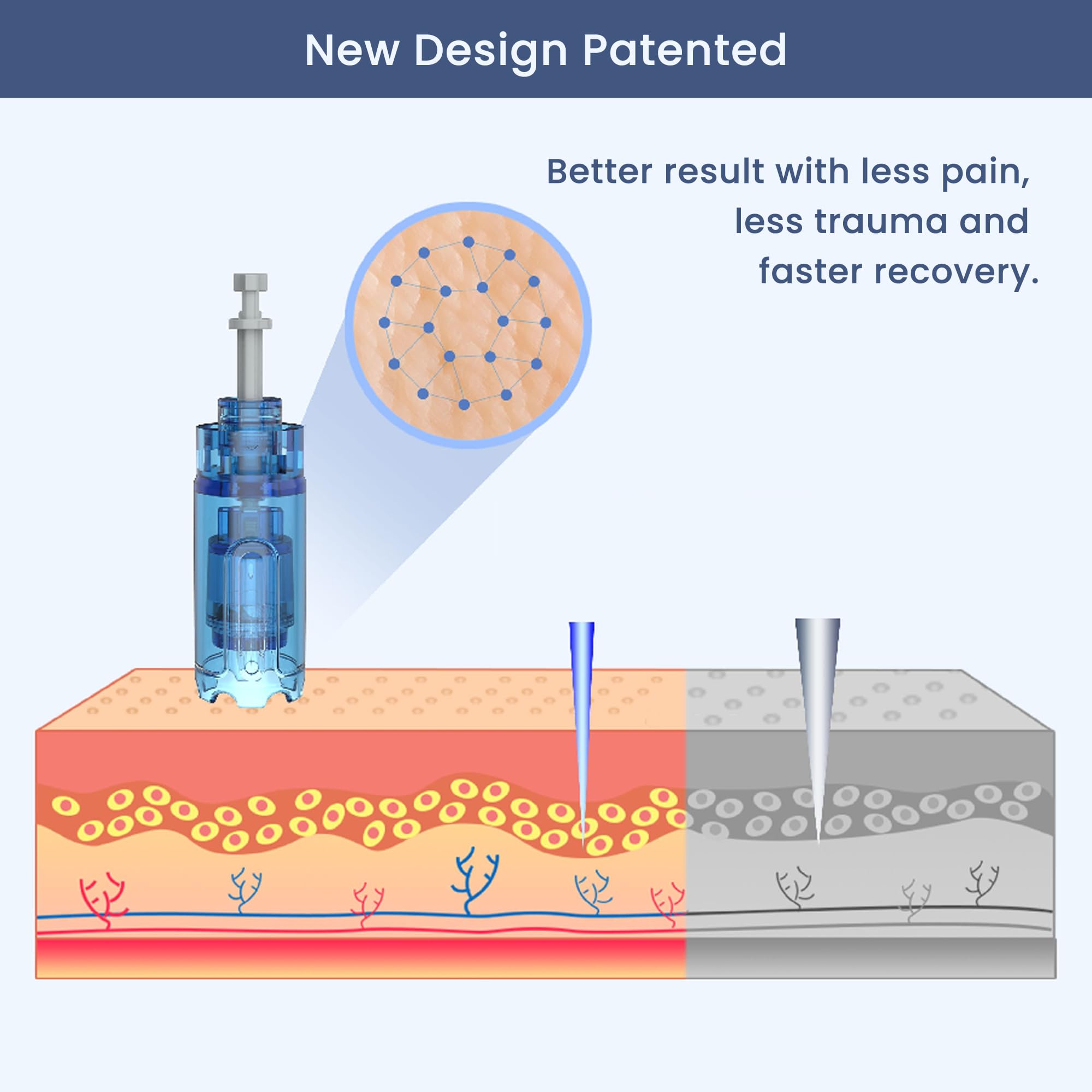 Dr Pen A11 - Penna per microneedling, per uso domestico, con micro aghi per la pelle, per uomini e donne, 0,25 mm