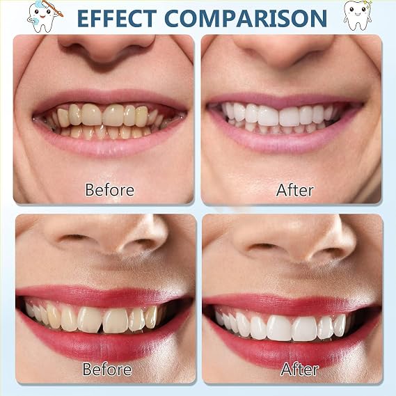 Wttfc 2Pairs,Denture Silicone Kit, Adjustable Snap On Dentures Set False Teeth Veneers Upper and Lower,Fake Teeth Instant Whitening Kit, Cosmetic Teeth Veneers Instant Veneers for Men and Women [Energy Class A]