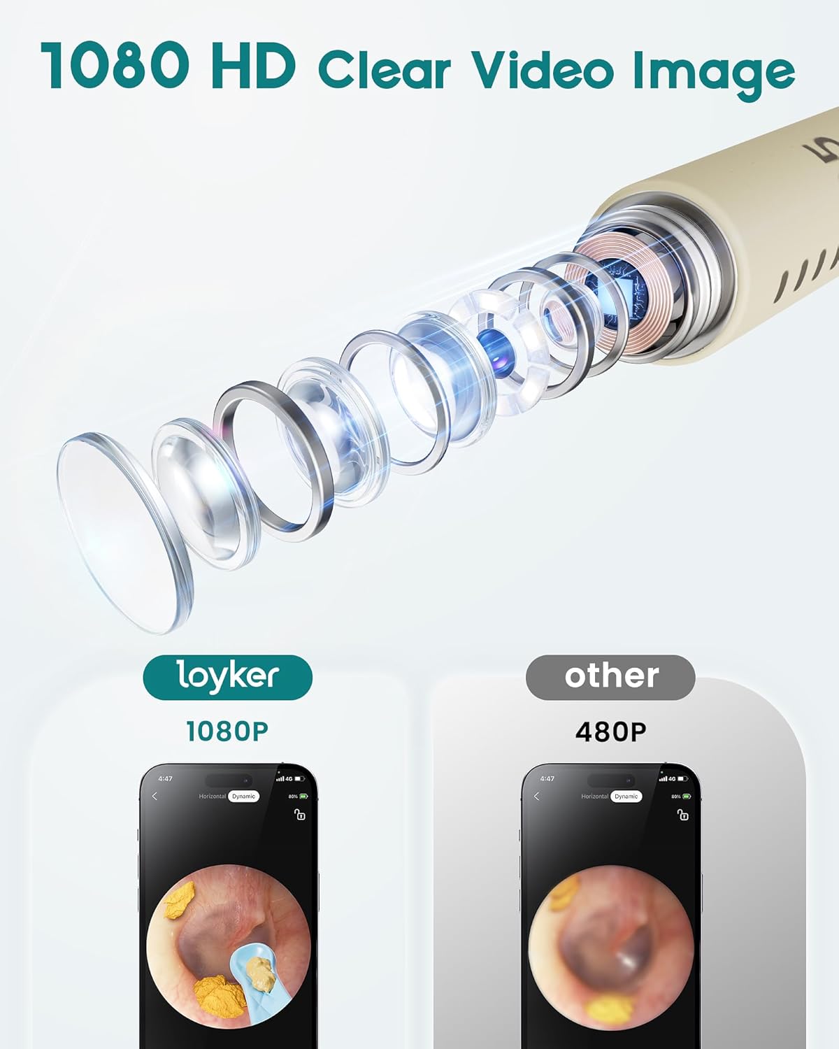 Loyker Ear Wax Removal, Ear Cleaner with 1080P Camera, Ear Cleaning Kit with 12 Ear Pick, Visual Ear Picker Earwax Remover Tweezers with 6LED Light, Ear Camera for iPhone, iPad, Android Phones, White