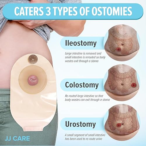 Miniatura 2 de JJ CARE Bolsas de colostomía, 20 unidades, bolsas de ostomía de una sola pieza, suministros de ostomía sin desorden para ileostomía, colostomía,
