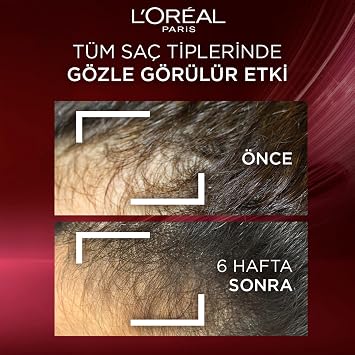 L'Oréal Paris Elseve Komple Direnç Dökülme Karşıtı Şampuan 700 ml