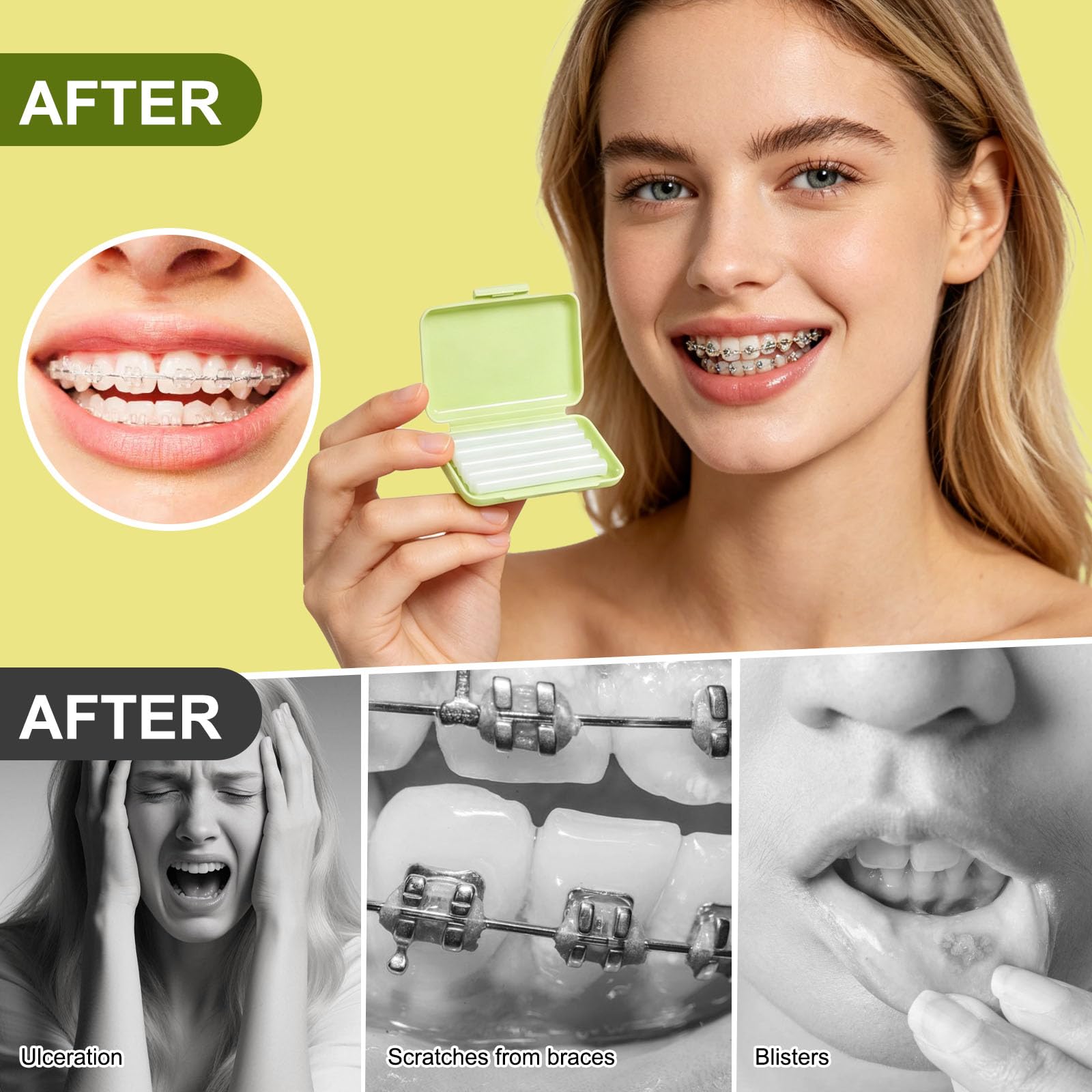 15 PCS Cire Orthodontique Cire Appareil Dentaire, 10 Saveurs Orthodontique Kits de Soins Dentaires de Soulagement, pour Porteurs D'appareil Dentaire, pour Soulager Les Irritations Et Les Douleurs