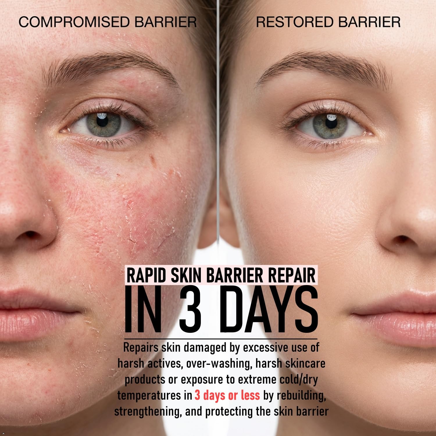 Advanced Rapid Skin Barrier Repair Soap/Serum with Collagen, Keratin Multi-Peptides and Growth Factors - Ceramides Booster and True Molecular Water Hydration 2-pack