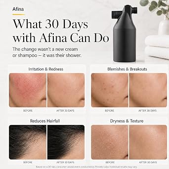 Afina Black High Pressure Revitalizing Shower Filter - Filters Out Chlorine | Reduces Dry Itchy Skin, Dandruff & Flaky Scalp; Improves Skin, Hair & Nails