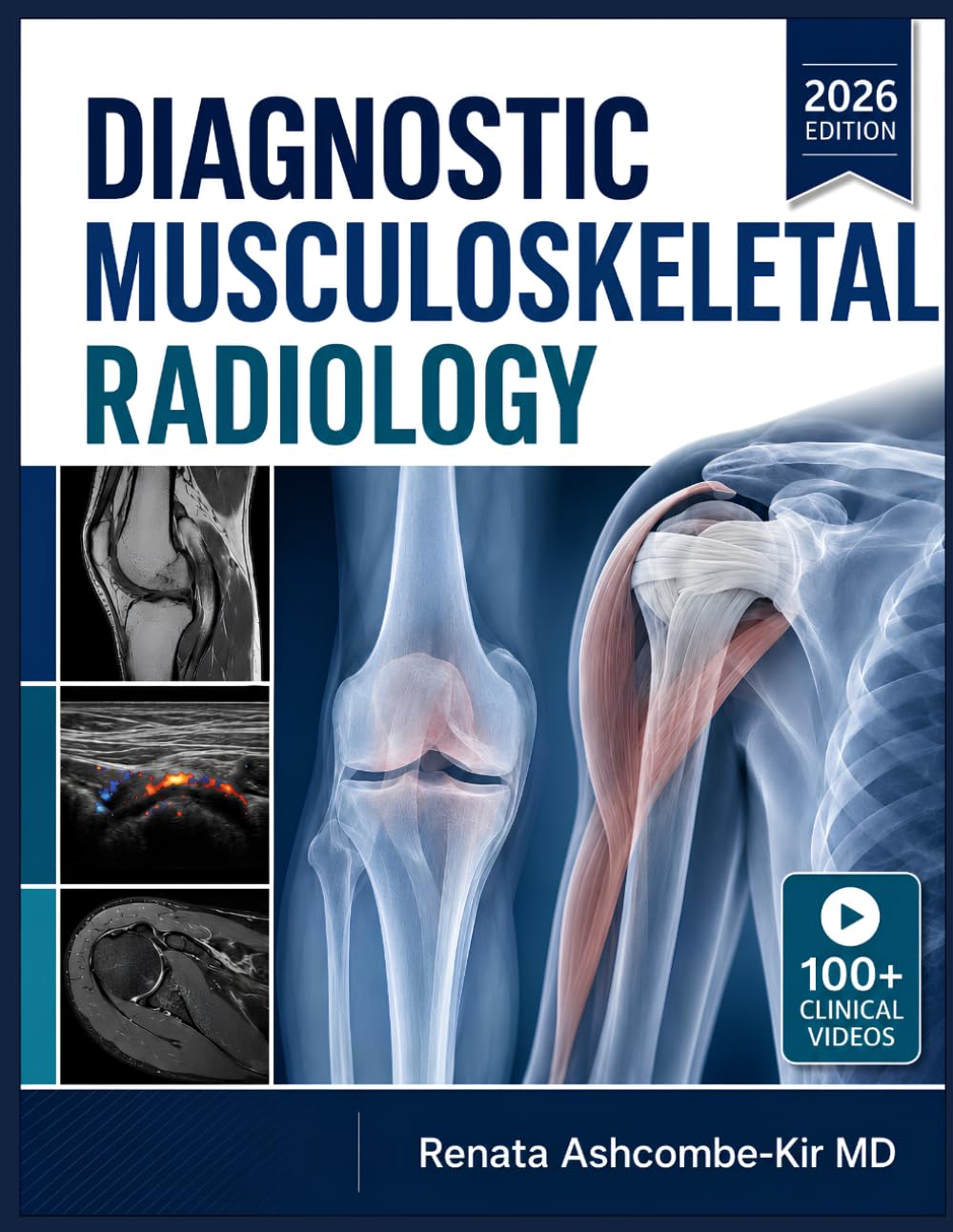 DIAGNOSTIC MUSCULOSKELETAL RADIOLOGY: A Complete Guide to Image Interpretation, Pattern Recognition, Differential Diagnosis, and Evidence Based Reporting of Bone, Joint, and Soft Tissue Conditions