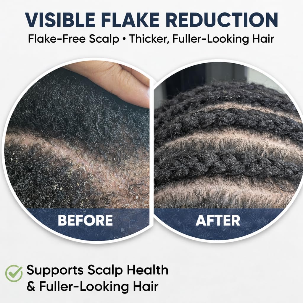 Fortify'd Naturals Growth Sensation Vitamin Infused Hair & Scalp Elixir – Supports Thicker, Fuller, Healthier Hair & Reduces Flakes and Scalp Itch, Non-Oil, Vegan Formula