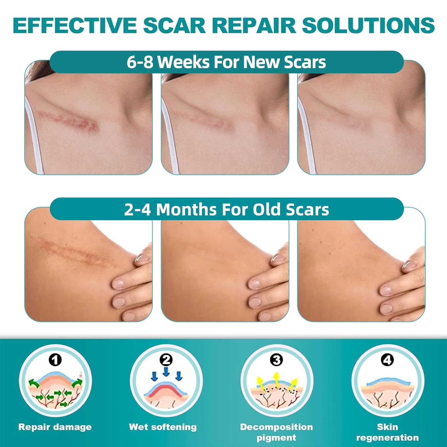 Extra Long Silicone Scar Sheets (1.6” x 200” Roll-5M), Silicone Scar Tape, Reusable Scar Removal Sheets, Professional Scar Strips for Surgical Scars, Keloid, C-Section, Burn, Acne et
