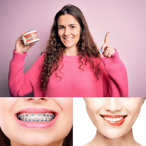 Miniatura 5 de Bandas de goma para aparatos ortopédicos, 1040 unidades de ligadura de ortodoncia negra, juntas tóricas, bandas elásticas