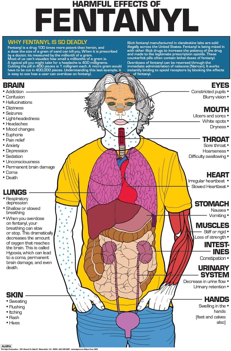 Fentanyl Effects Educational Poster (24" x 36") Laminated – Drug Awareness Chart for Schools, Clinics & Law Enforcement – Made in USA | ALGRA