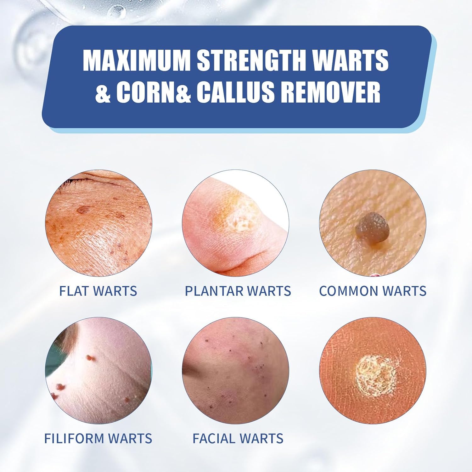Fast-Acting Wart Remover Gel for Feet & Hands, Nature Plant-Based Formula - Genital, Common Warts & Plantar wart Remover, Safe for Kids & Sensitive Skin, Non-Invasive Home Care - Image 4