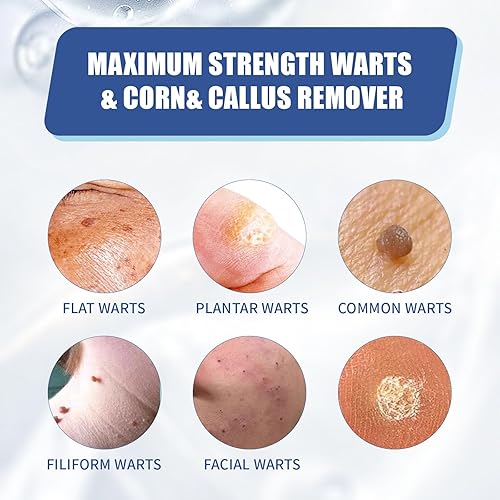 Miniatura 4 de Mrkayll Gel Removedor de Verrugas de Acción Rápida para Pies y Manos, Fórmula Natural a Base de Plantas - Removedor de Verrugas Genitales, Comunes y