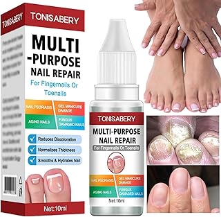 Fungal Nail Treatment,Natural Strong Nail Fungus Treatment for Toenail,Nail Growth treatment,fungal nail treatment for toenails extra strong,Toe Nail Fungal Treatment,Anti Fungal Nail Treatment