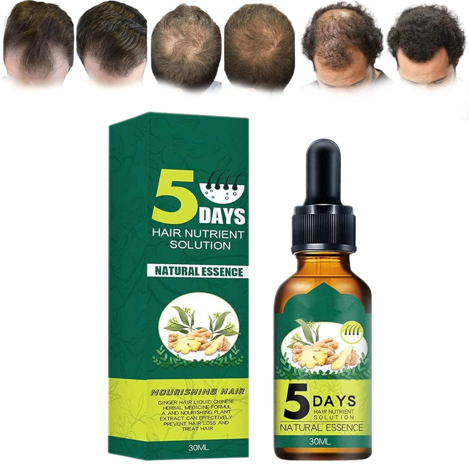 Prox Shouga Essence Hair Growth Oil, Prox Shouga Kingu