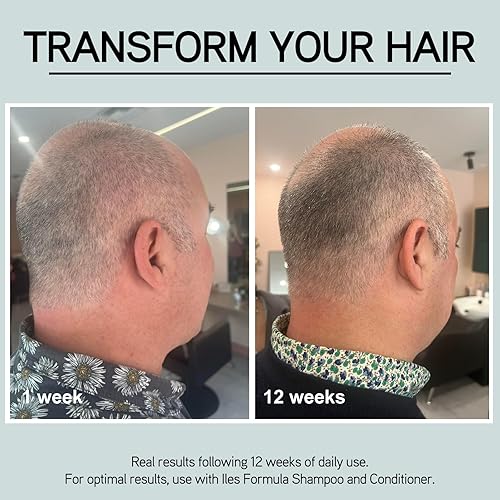 Miniatura 4 de ILES FORMULA Refuerzo de cabello anti gris retardado  Spray de tratamiento botánico sin enjuague con Silverfree y Melanogray para restaurar el color