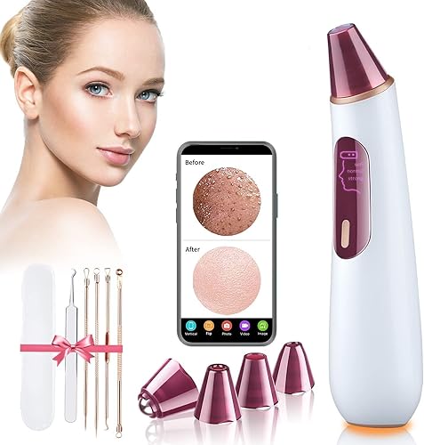 EORYNOL Aspiradora de poros con cámara para eliminar puntos negros, aspiradora eléctrica Slacklinepore, eliminador de cabezales negros de cara,