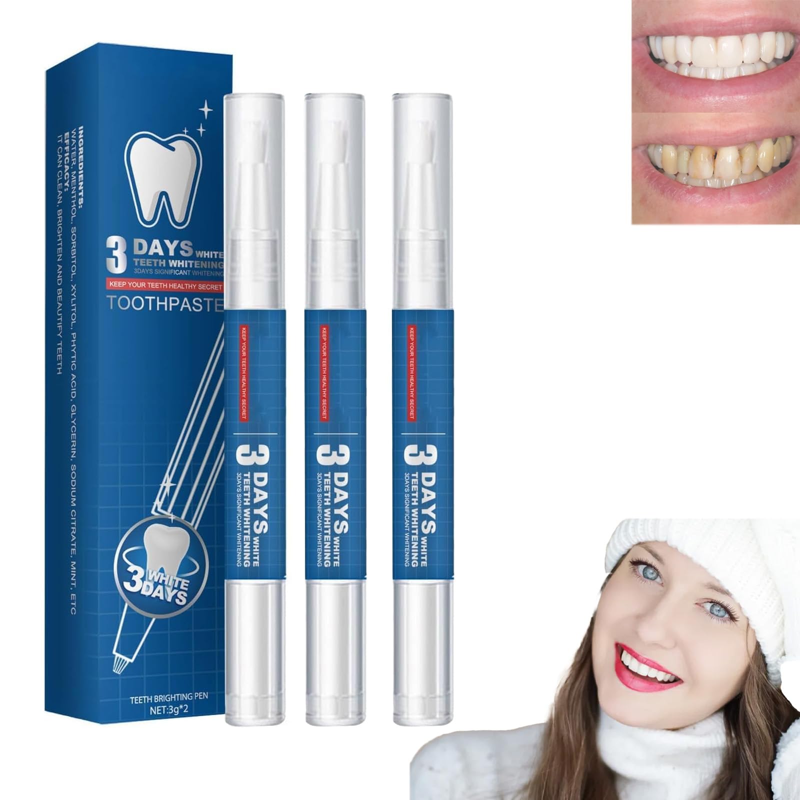 Glowbrite,Glowbrite Teeth Whitening Gel Pen，Teeth Whitening for Sensitive Teeth and Gums,Glowbrite (3PCS)