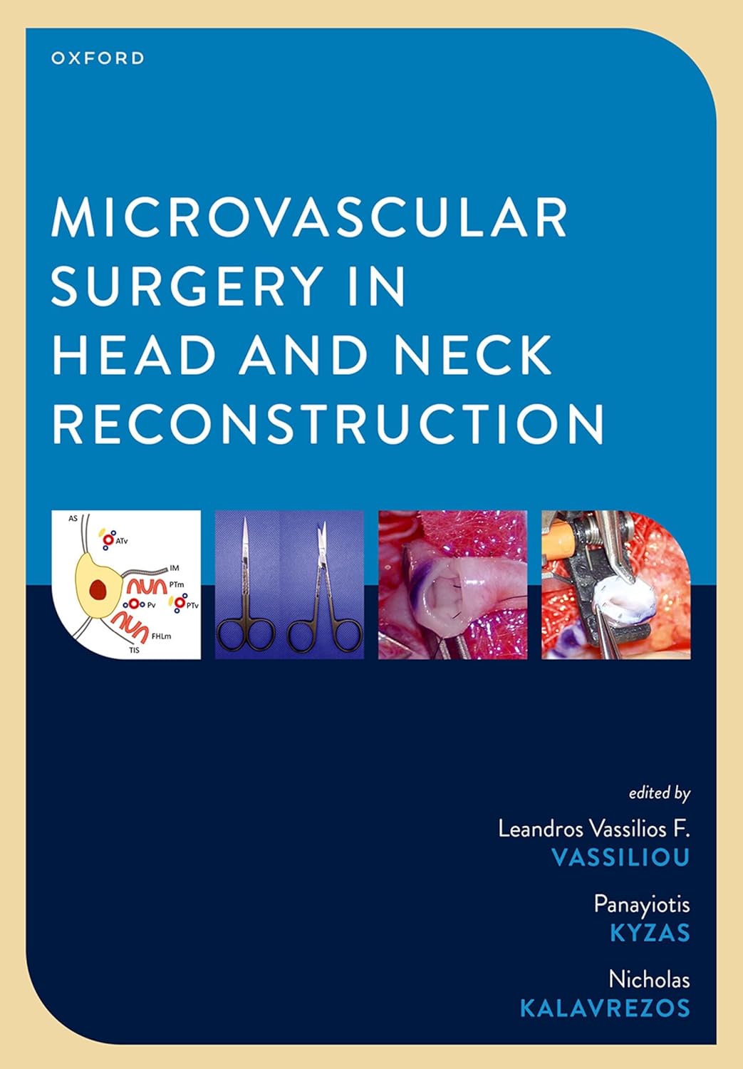 Microvascular Surgery in Head and Neck Reconstruction      Kindle Edition