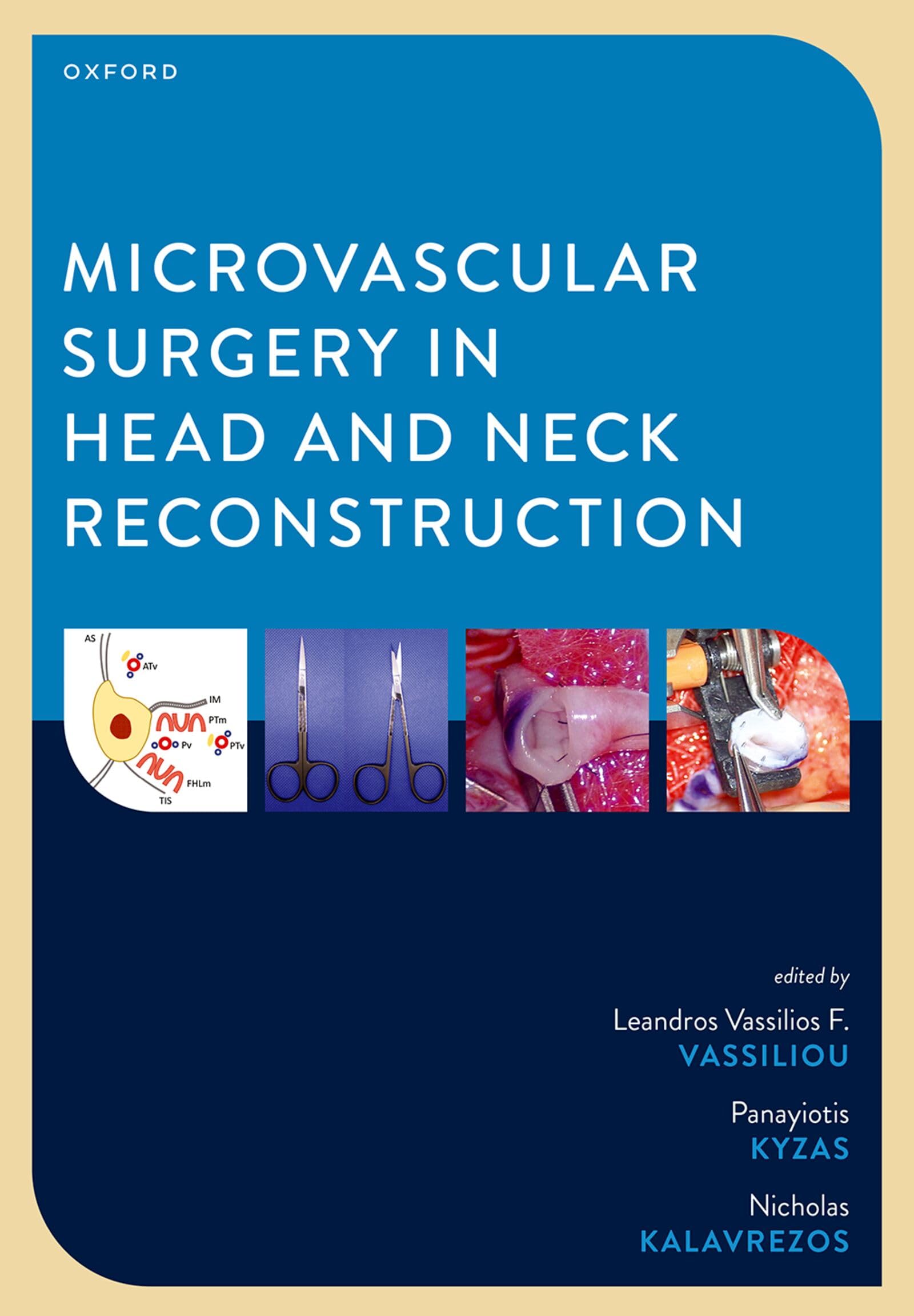 Microvascular Surgery in Head and Neck Reconstruction : Vassiliou