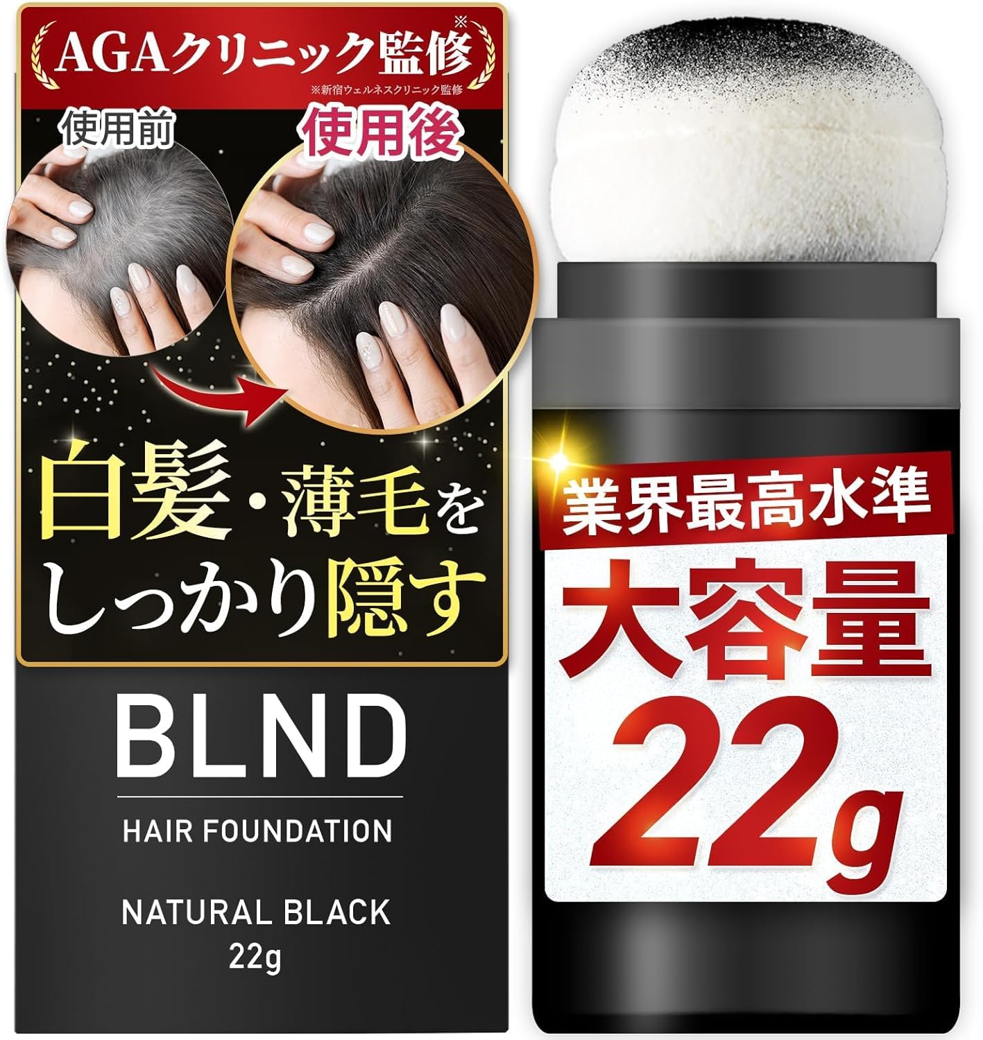 【AGAクリニック監修】ヘアファンデーシ