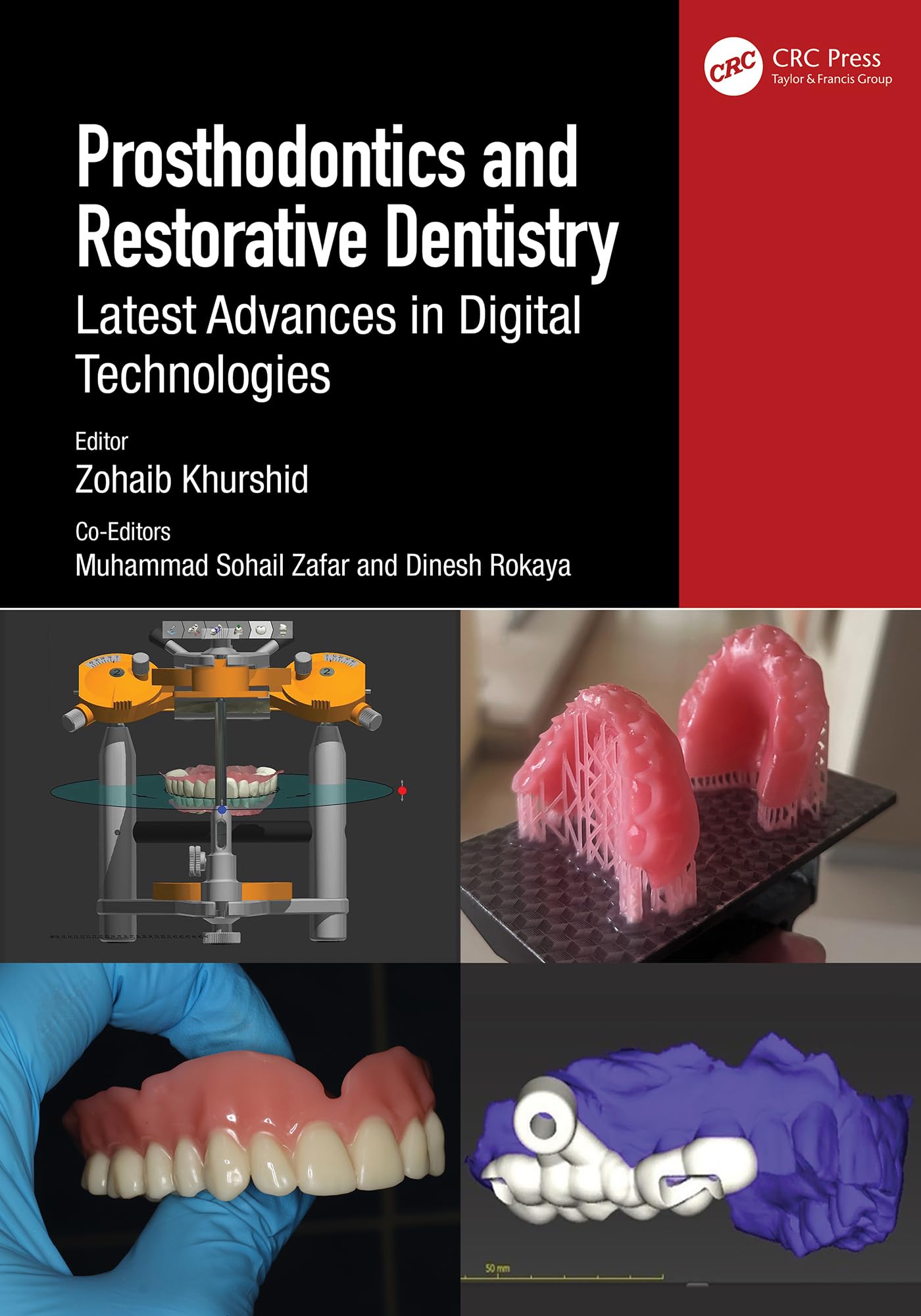 Prosthodontics and Restorative Dentistry: Latest Advances in Digital Technologies (English Edition)